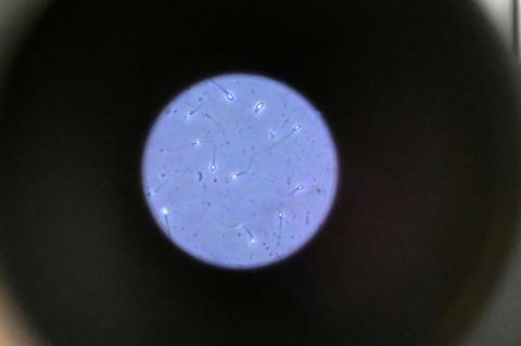 Des spermatozoïdes humains observés au microscope, le 17 novembre 2024 à Rennes
