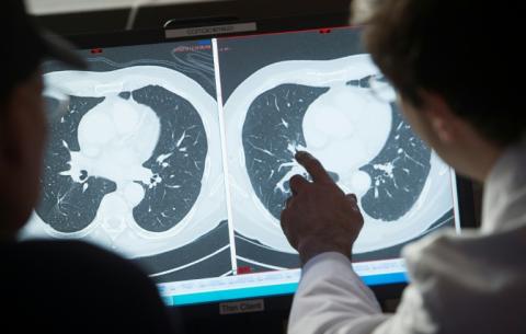 Nicht nur das kalendarische Alter, sondern auch die individuelle Alterung hat laut einer Studie Einfluss auf das Krebsrisiko. Eine schnellere biologische Alterung erhöht das Risiko zusätzlich, wie das Deutsche Krebsforschungszentrum mitteilte.
