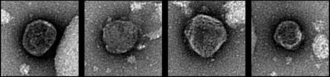 Images non datées, obtenues par microscopie électronique à coloration négative et publiées par Cell Press le 6 mars 2026, montrant un reptarénavirus de serpent associé à un deltavirus de serpent